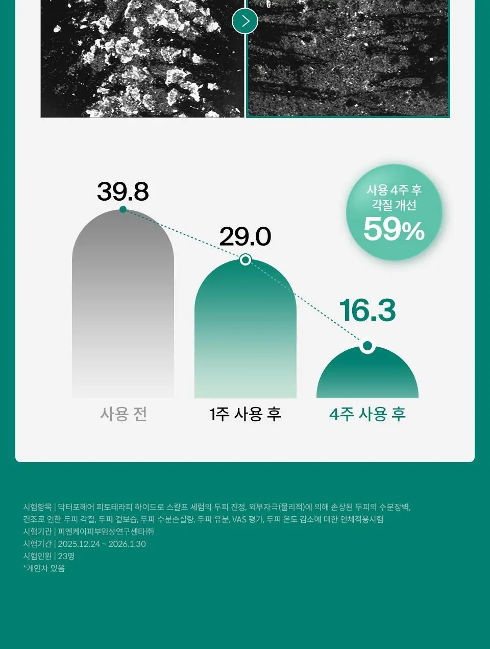 [NEW] 닥터포헤어 피토테라피 하이드로 스칼프 세럼 60ml 상세페이지 13